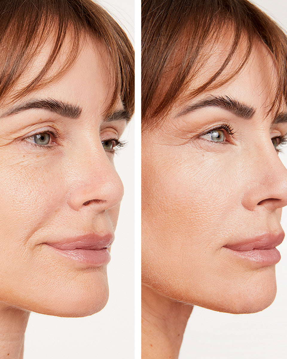 Slow Aging Repair Plan - Face and eyes