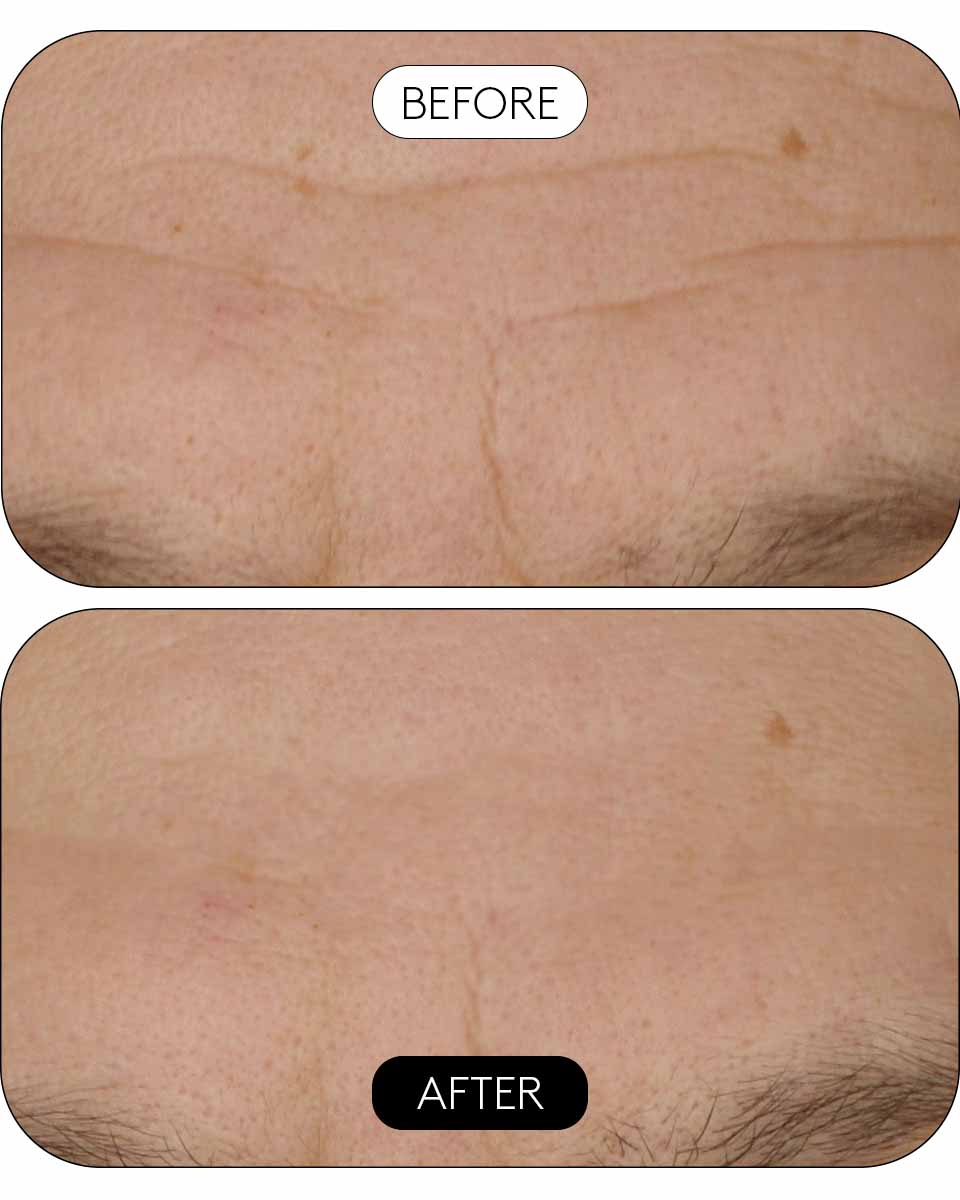 CLINICAL BEAUTY FILLER