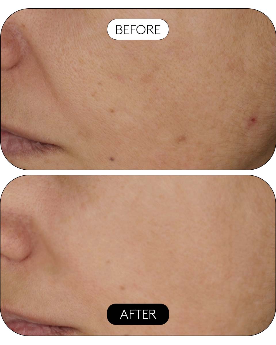CLINICAL BEAUTY FILLER