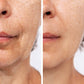 Skin Cycling Advanced