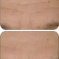 CLINICAL BEAUTY FILLER | 2 MONTH