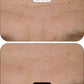 CLINICAL BEAUTY FILLER