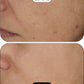 CLINICAL BEAUTY FILLER